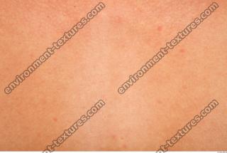 photo texture of white skin 0008